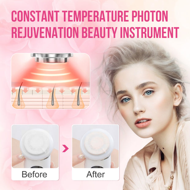 IPL Face-lifting Skin Rejuvenation Device - My Store