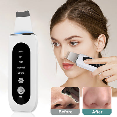 Ultrasonic Blackhead Skin Scraper - My Store