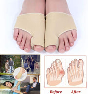 Toe Splint Correctors - My Store