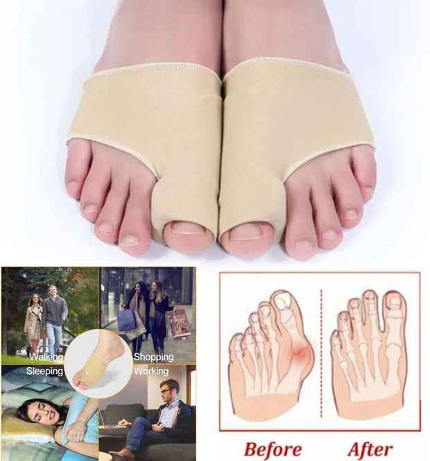 Toe Splint Correctors - My Store